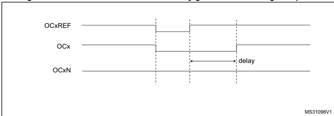 Timing diagram showing dead-time waveforms where the delay is greater than the negative pulse width. It includes signals OCxREF, OCx, and OCxN with a 'delay' label indicating the dead-time interval.