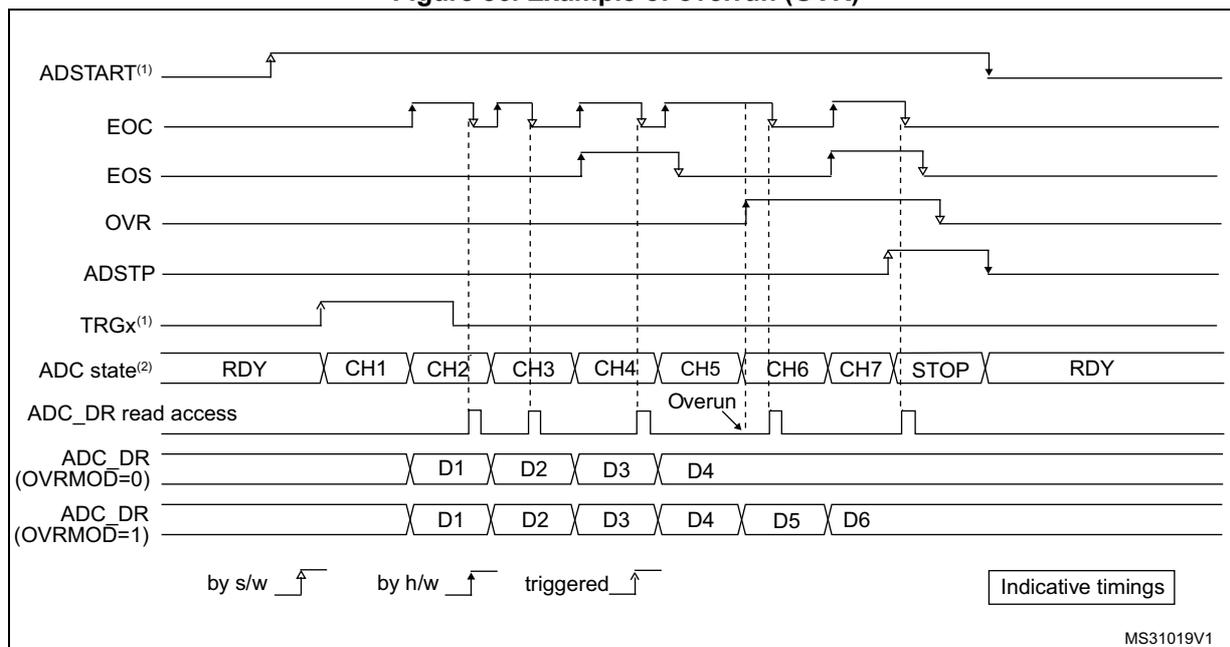 Timing diagram illustrating an ADC overrun event. The diagram shows the relationship between ADSTART, EOC, EOS, OVR, ADSTP, TRGx, ADC state, ADC_DR read access, and ADC_DR values for two OVRMOD settings. An overrun occurs when a new conversion (CH5) completes before the previous data (CH4) is read, causing the OVR flag to be set. In OVRMOD=0, the data for CH5 is lost. In OVRMOD=1, the data for CH4 is overwritten by CH5.