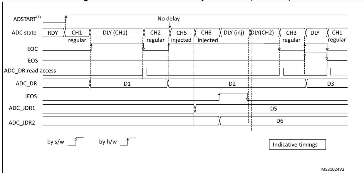 Timing diagram for Figure 62 showing regular conversions (CH1, CH2, CH3) and injected conversions (CH5, CH6) in auto-injected mode (JAUTO=1).