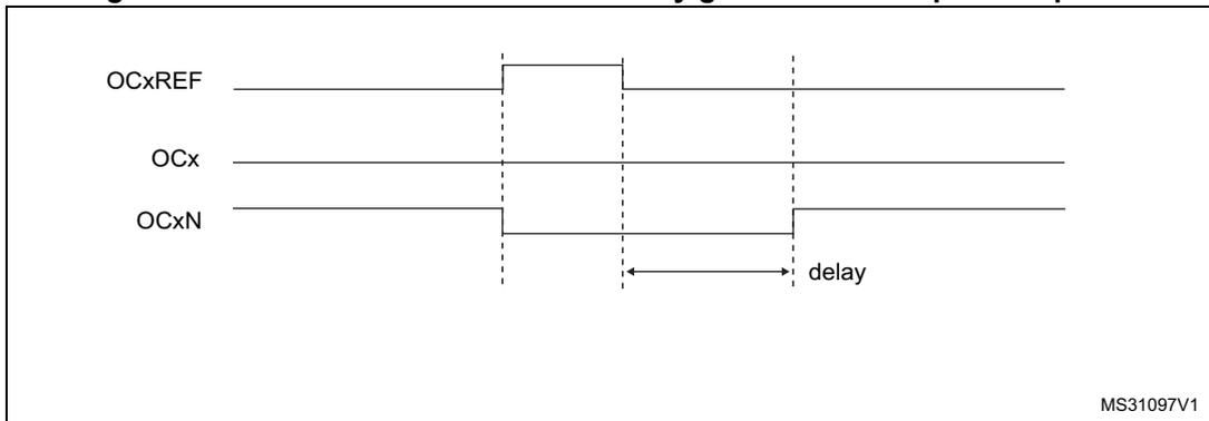 Timing diagram for Figure 75 showing OCxREF, OCx, and OCxN waveforms where the dead-time delay is greater than the positive pulse width. OCxREF is a reference signal. OCx and OCxN are complementary outputs. Dead-time is indicated by an arrow between the rising edge of OCx and the falling edge of OCxN.