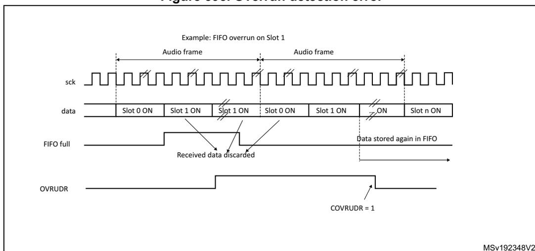 Timing diagram for Figure 395 showing an overrun detection error. The diagram includes four waveforms: sck (serial clock), data, FIFO full, and OVRUDR. The sck waveform is a periodic square wave. The data waveform shows a sequence of slots: Slot 0 ON, Slot 1 ON, Slot 1 ON (marked with a slash), Slot 0 ON, Slot 1 ON, Slot n ON (marked with a slash), and Slot n ON. The FIFO full waveform is a step function that goes high when the FIFO is full and low when it is not. The OVRUDR waveform is a step function that goes high when the overrun detection flag is set. The diagram shows that when the FIFO is full, new data for Slot 1 is discarded, and the OVRUDR flag is set. The text 'Received data discarded' is present, and 'COVRUDR = 1' is indicated at the end of the OVRUDR signal. The MSV192348V2 identifier is in the bottom right corner.