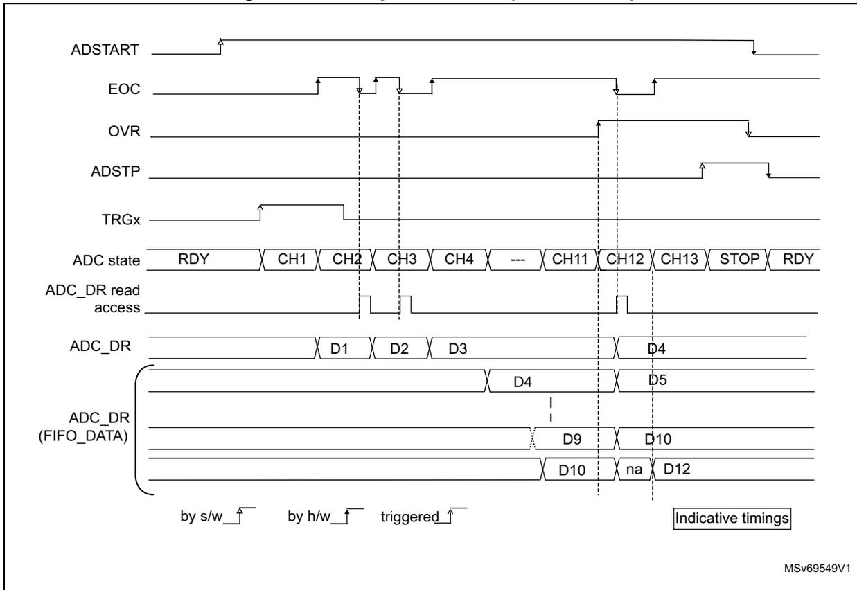 Timing diagram for Figure 170 showing an overrun condition when OVRMOD = 0. The diagram illustrates the relationship between ADSTART, EOC, OVR, ADSTP, TRGx, ADC state, ADC_DR read access, and ADC_DR (FIFO_DATA) signals. It shows that when a new conversion result is ready before the previous one is read, the data is lost in the FIFO.