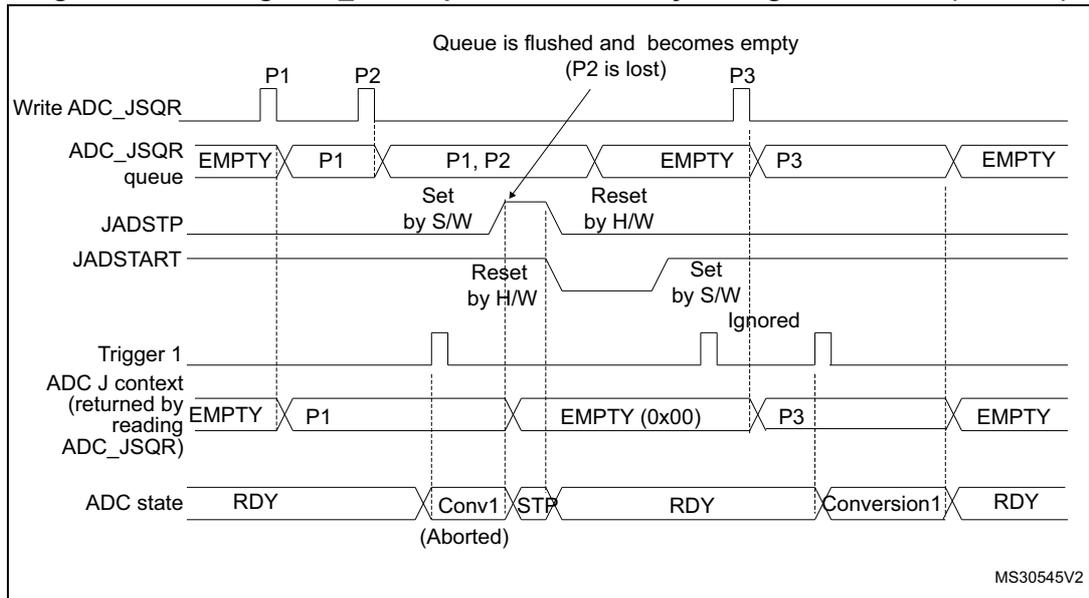 Timing diagram for Figure 72 showing the effect of setting JADSTP = 1 on the ADC_JSQR queue. The diagram illustrates the queue state, JADSTP and JADSTART signals, trigger events, and the resulting ADC state when a new context is added while the queue is full.