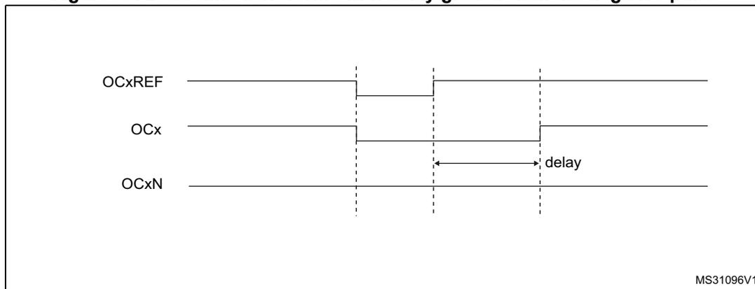 Timing diagram for Figure 96 showing OCxREF, OCx, and OCxN waveforms where the dead-time delay is greater than the negative pulse width.