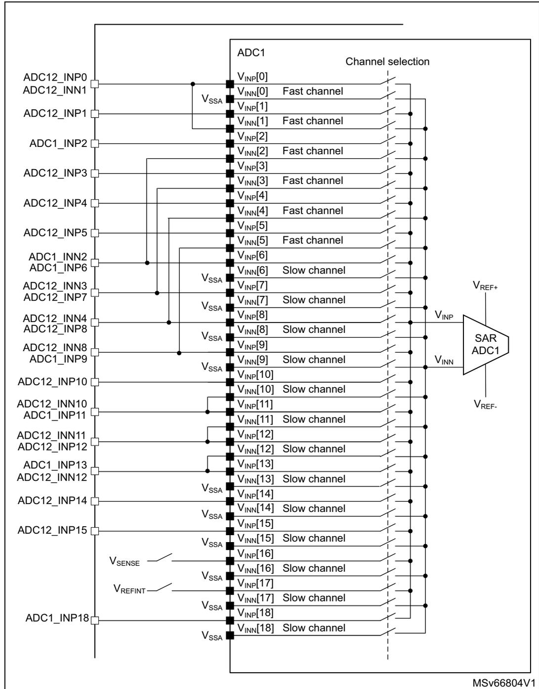 Schematic diagram of ADC1 connectivity showing various input channels (ADC12_INP0 to ADC1_INP18) connected to a central ADC1 block. The block lists internal channels V_INP[0] to V_INP[18] and V_INN[0] to V_INN[18], categorized as 'Fast channel' or 'Slow channel'. It also shows connections to internal sources like V_SSA, V_SENSE, and V_REFINT, and to an external SAR ADC1 block with V_REF+, V_INP, V_INN, and V_REF- pins. MSv66804V1 is noted at the bottom right.