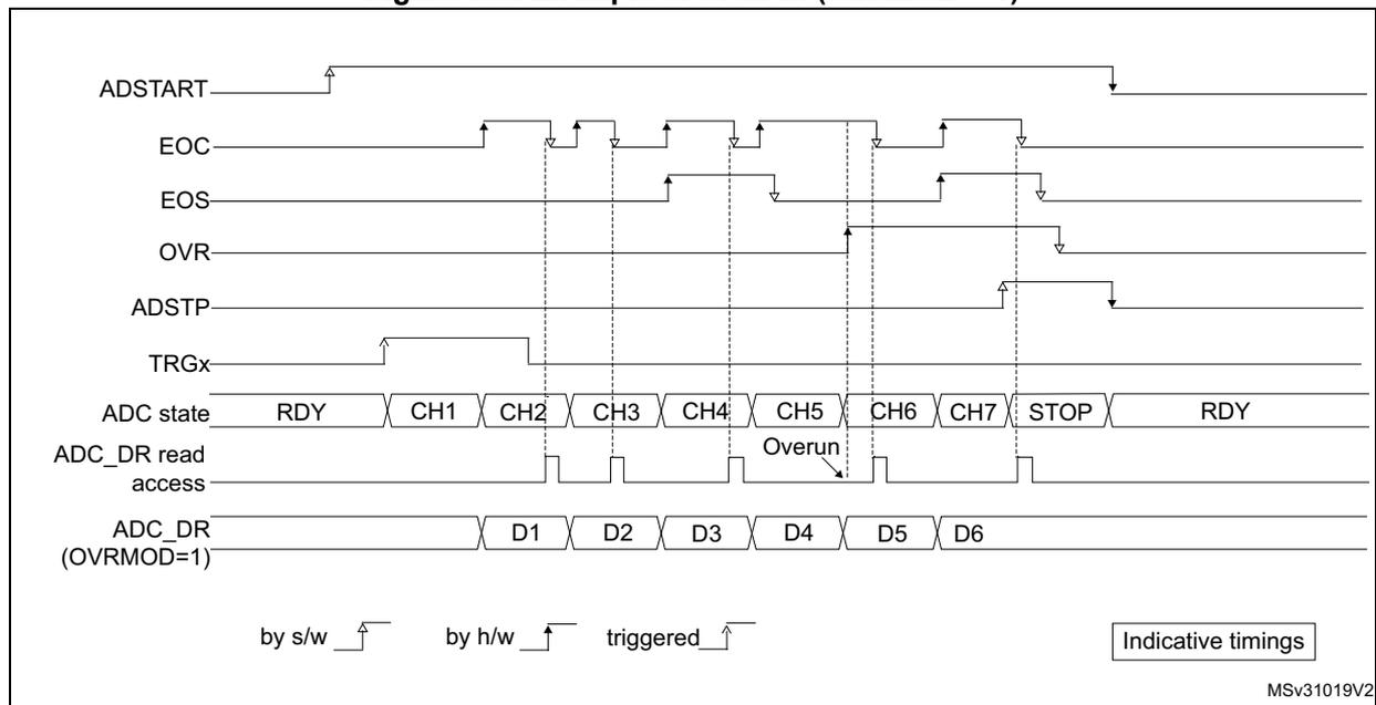 Timing diagram for Figure 199: Example of overrun (OVRMOD = 1).