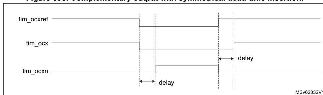 Timing diagram showing complementary output with symmetrical dead-time insertion. The diagram displays three waveforms: tim_ocxref (reference), tim_ocx (output), and tim_ocxn (complementary output). The tim_ocxref signal is a square wave. The tim_ocx signal is delayed on the rising edge relative to tim_ocxref. The tim_ocxn signal is delayed on the falling edge relative to tim_ocxref. The delay is symmetrical for both edges. The diagram is labeled with 'delay' for both rising and falling edges. The source identifier MSV62332V1 is visible in the bottom right corner.